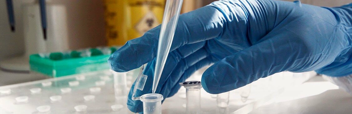  ����� 100 ��� ���� ��� ������ ��� ������� 