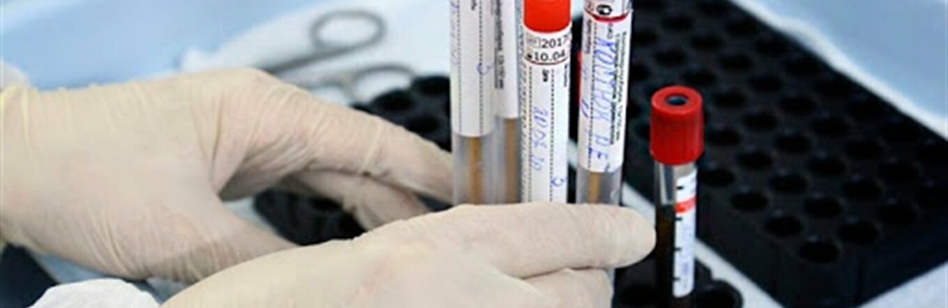  ���������� ��� ��� ������ covid-19 ���� ������ ����� 