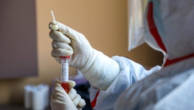 Де безкоштовно зробити тест: адреси пунктів тестування в Кременчуці та районі