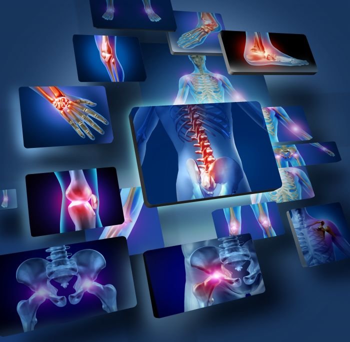Fotolia_49017737_SubscriptionArthritis